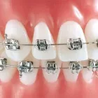 La imagen 1 de la Empresa BRACKETS CON ESTILO GUADALAJARA Salud y Medicina en Guadalajara JAL