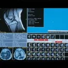 La imagen 3 de la Empresa CENTRO DE IMAGEN DIAGNÓSTICA Salud y Medicina en Nuevo Laredo TAM