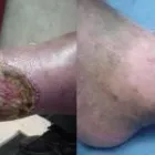 La imagen 10 de la Empresa CLINICA DE OZONOTERAPIA Salud y Medicina en Villahermosa TAB