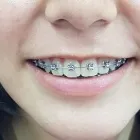 La imagen 1 de la Empresa CONSULTORIO DENTAL DE ORTODONCIA Salud y Medicina en Uruapan MIC