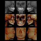 La imagen 3 de la Empresa DIAGNÓSTICO MÉDICO DENTAL POR IMAGEN SC Salud y Medicina en Ciudad Juárez CHH