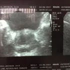 La imagen 2 de la Empresa DR ALEJANDRO SANTOYO TRUJILLO Salud y Medicina en Aguascalientes Agu