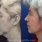 La imagen 4 de la Empresa DR. GERARDO CASTILLO GARZA Salud y Medicina en San Pedro Garza García NLE