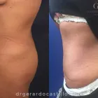 La imagen 5 de la Empresa DR. GERARDO CASTILLO GARZA Salud y Medicina en San Pedro Garza García NLE