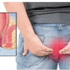 La imagen 3 de la Empresa DR. GERARDO GONZÁLEZ COLOPROCTÓLOGO Salud y Medicina en Xalapa VER