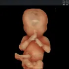 La imagen 6 de la Empresa DR. JOSE ANTONIO MÉNDEZ GONZÁLEZ Salud y Medicina en Querétaro QUE