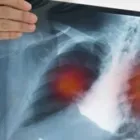 La imagen 2 de la Empresa DR. LIMBERTH MACHADO VILLARROEL Salud y Medicina en Ciudad Juárez CHH
