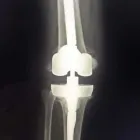 La imagen 1 de la Empresa DR VICTOR T. INFANSON TRAUMA ORTOPEDISTA Salud y Medicina en Agua Prieta SON