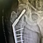 La imagen 2 de la Empresa DR VICTOR T. INFANSON TRAUMA ORTOPEDISTA Salud y Medicina en Agua Prieta SON