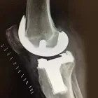 La imagen 3 de la Empresa DR VICTOR T. INFANSON TRAUMA ORTOPEDISTA Salud y Medicina en Agua Prieta SON
