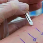 La imagen 3 de la Empresa DRA ANGELES JUAN PINEDA Salud y Medicina en Puerto Vallarta JAL