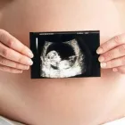 La imagen 1 de la Empresa DRA. RAQUEL SCARLETH BARRADAS PEREGRINA Salud y Medicina en Puebla MEX