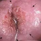 La imagen 2 de la Empresa DRA YUCKARI CARBAJAL JIMÉNEZ Salud y Medicina en Poza Rica VER