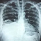 La imagen 1 de la Empresa GABINETE DE RADIOLOGIA Y ULTRASONIDO SAN CRISTOBAL Salud y Medicina en Mérida YUC