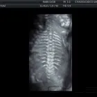 La imagen 15 de la Empresa GABINETE DE RADIOLOGIA Y ULTRASONIDO SAN CRISTOBAL Salud y Medicina en Mérida YUC