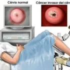 La imagen 2 de la Empresa GYNEKITO Salud y Medicina en Pachuca HID