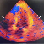 La imagen 2 de la Empresa ÍNIMA- CENTRO DE DIAGNOSTICO CARDIOVASCULAR Salud y Medicina en Heroica Puebla De Zaragoza PUE