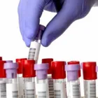 La imagen 2 de la Empresa LABORATORIOS MICROCLIN Salud y Medicina en Tepic NAY