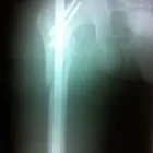 La imagen 4 de la Empresa MARTÍN JIMÉNEZ NAVARRO Salud y Medicina en Ciudad Juárez CHH