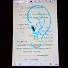 La imagen 2 de la Empresa OTO-MEDIC-K Salud y Medicina en Veracruz VER
