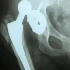 La imagen 6 de la Empresa RADIOGRAFIAS A DOMICILIO Salud y Medicina en Ciudad De México CMX