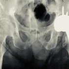 La imagen 7 de la Empresa RADIOGRAFIAS A DOMICILIO Salud y Medicina en Ciudad De México CMX