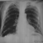 La imagen 11 de la Empresa RADIOGRAFIAS A DOMICILIO Salud y Medicina en Ciudad De México CMX