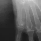 La imagen 12 de la Empresa RADIOGRAFIAS A DOMICILIO Salud y Medicina en Ciudad De México CMX