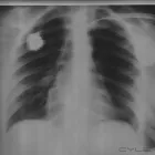 La imagen 13 de la Empresa RADIOGRAFIAS A DOMICILIO Salud y Medicina en Ciudad De México CMX
