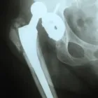 La imagen 14 de la Empresa RADIOGRAFIAS A DOMICILIO Salud y Medicina en Ciudad De México CMX