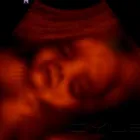 La imagen 1 de la Empresa SONOGRAFIA ESPECIALIZADA Salud y Medicina en Niños Héroes CHH