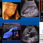 La imagen 4 de la Empresa SONOGRAFIA ESPECIALIZADA Salud y Medicina en Niños Héroes CHH