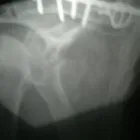 La imagen 1 de la Empresa TRAUMATOLOGIA Y ORTOPEDIA DR. GOMEZ ROJAS. Salud y Medicina en Toluca De Lerdo MEX