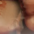La imagen 1 de la Empresa ULTRASONIDOS 4D HD LIVE EN GUADALAJARA DIAGNOSTICO FETAL Salud y Medicina en Zapopan JAL