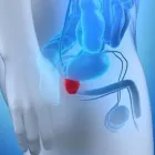 La imagen 2 de la Empresa UNIDAD AVANZADA DE UROLOGÍA Salud y Medicina en Villahermosa TAB