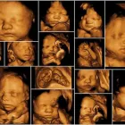 La imagen 1 de la Empresa UNIDAD DE IMAGEN EN 3D Salud y Medicina en Mexico CMX