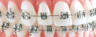 La imagen 1 de la Empresa BRACKETS CON ESTILO GUADALAJARA Salud y Medicina en Guadalajara JAL