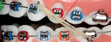 La imagen 2 de la Empresa BRACKETS CON ESTILO GUADALAJARA Salud y Medicina en Guadalajara JAL