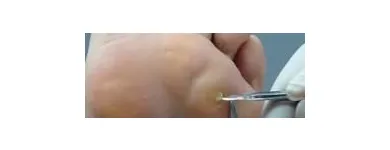 La imagen 2 de la Empresa CLINICA DE OZONOTERAPIA Salud y Medicina en Villahermosa TAB