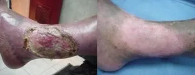 La imagen 10 de la Empresa CLINICA DE OZONOTERAPIA Salud y Medicina en Villahermosa TAB
