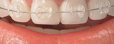 La imagen 3 de la Empresa DENTAL ADAME Salud y Medicina en Parral CHH