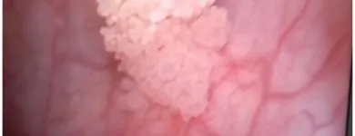 La imagen 2 de la Empresa DR EDUARDO GONZALEZ SANTISTEBAN Salud y Medicina en Veracruz VER