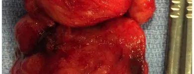 La imagen 3 de la Empresa DR EDUARDO GONZALEZ SANTISTEBAN Salud y Medicina en Veracruz VER