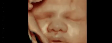 La imagen 4 de la Empresa DR. JOSE ANTONIO MÉNDEZ GONZÁLEZ Salud y Medicina en Querétaro QUE