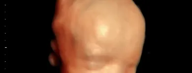 La imagen 5 de la Empresa DR. JOSE ANTONIO MÉNDEZ GONZÁLEZ Salud y Medicina en Querétaro QUE