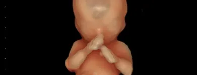 La imagen 6 de la Empresa DR. JOSE ANTONIO MÉNDEZ GONZÁLEZ Salud y Medicina en Querétaro QUE