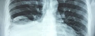 La imagen 1 de la Empresa GABINETE DE RADIOLOGIA Y ULTRASONIDO SAN CRISTOBAL Salud y Medicina en Mérida YUC