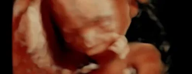 La imagen 11 de la Empresa GABINETE DE RADIOLOGIA Y ULTRASONIDO SAN CRISTOBAL Salud y Medicina en Mérida YUC