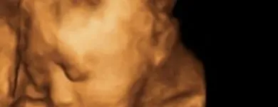 La imagen 19 de la Empresa GABINETE DE RADIOLOGIA Y ULTRASONIDO SAN CRISTOBAL Salud y Medicina en Mérida YUC