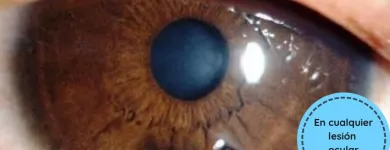 La imagen 3 de la Empresa OFTALMOLOGIA LASER Salud y Medicina en Ciudad De México CMX